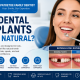 Do Dental Implants Feel Natural Everything You Need to Know Before Getting Dental Implants