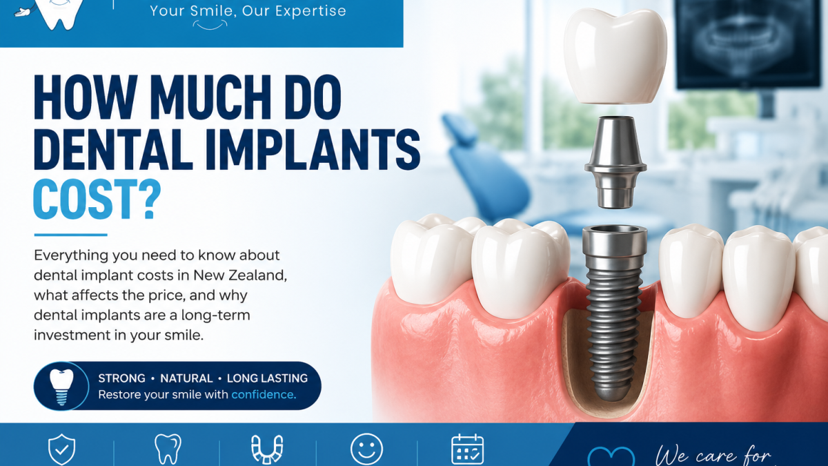 How Much Do Dental Implants Cost