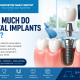 How Much Do Dental Implants Cost