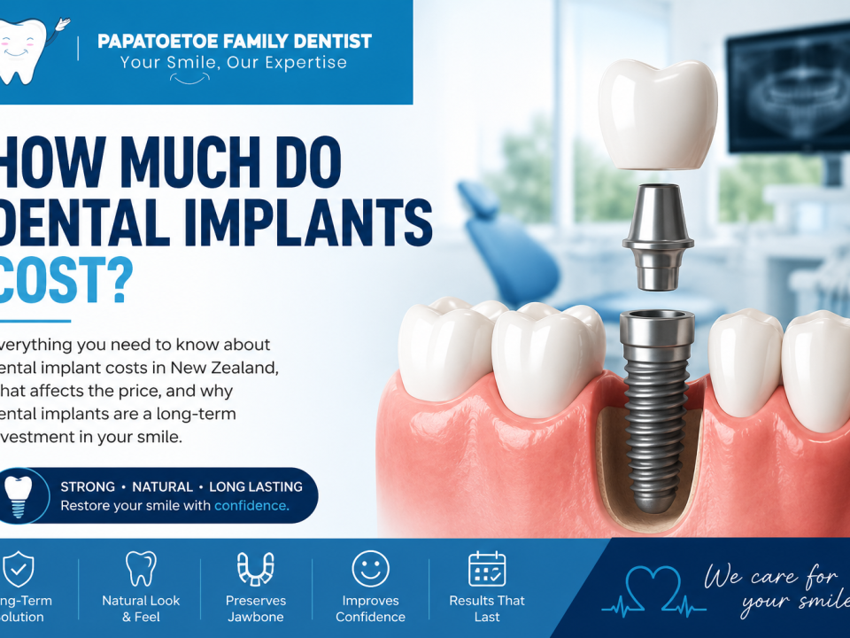 How Much Do Dental Implants Cost