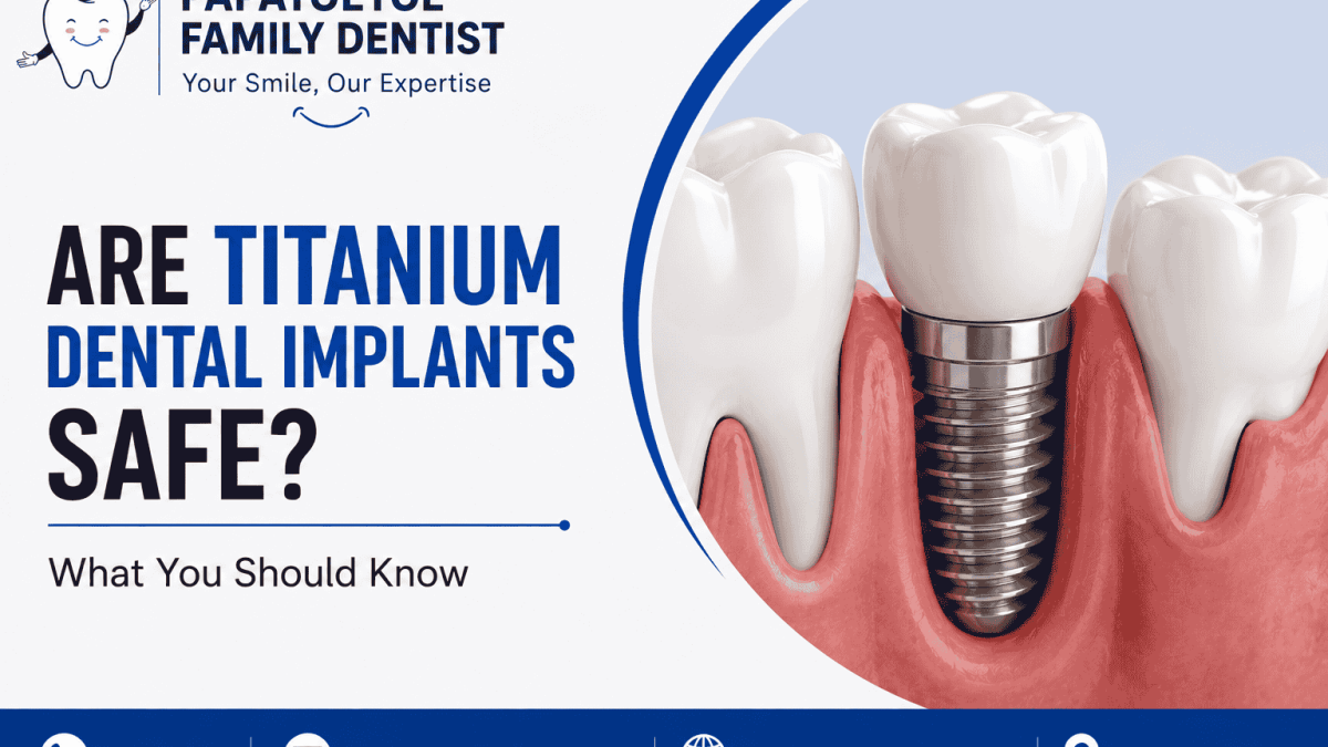Are Titanium Dental Implants Safe? What You Should Know