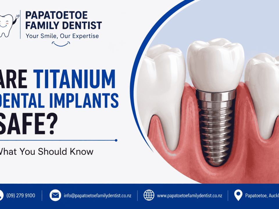 Are Titanium Dental Implants Safe? What You Should Know