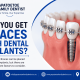 Can You Get Braces With Dental Implants