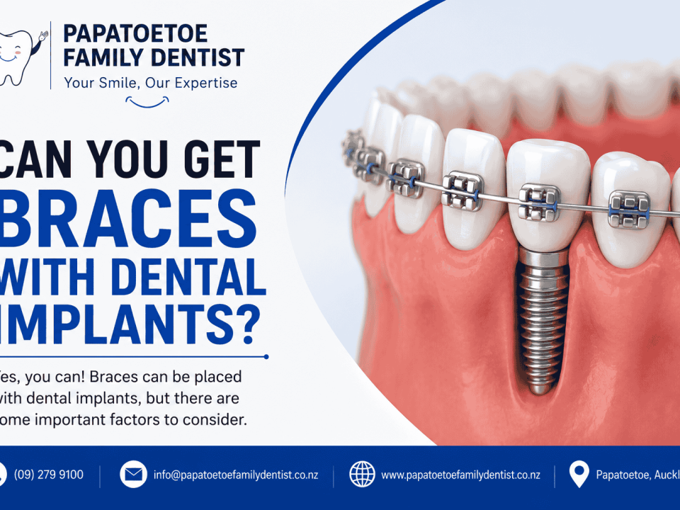 Can You Get Braces With Dental Implants
